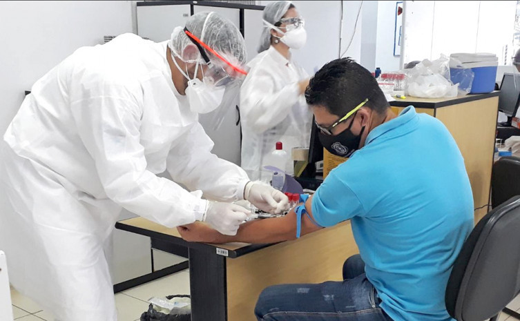 Servidores do É Pra Já de Araguaína são testados negativo para Covid-19