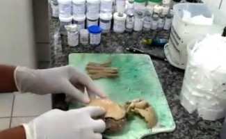 Exames realizados em amostras coletadas no interior de Jacaré-Açu dispensam DNA