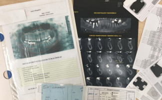 Policia Científica conscientiza sobre  manutenção de prontuários para identificação por arcadas