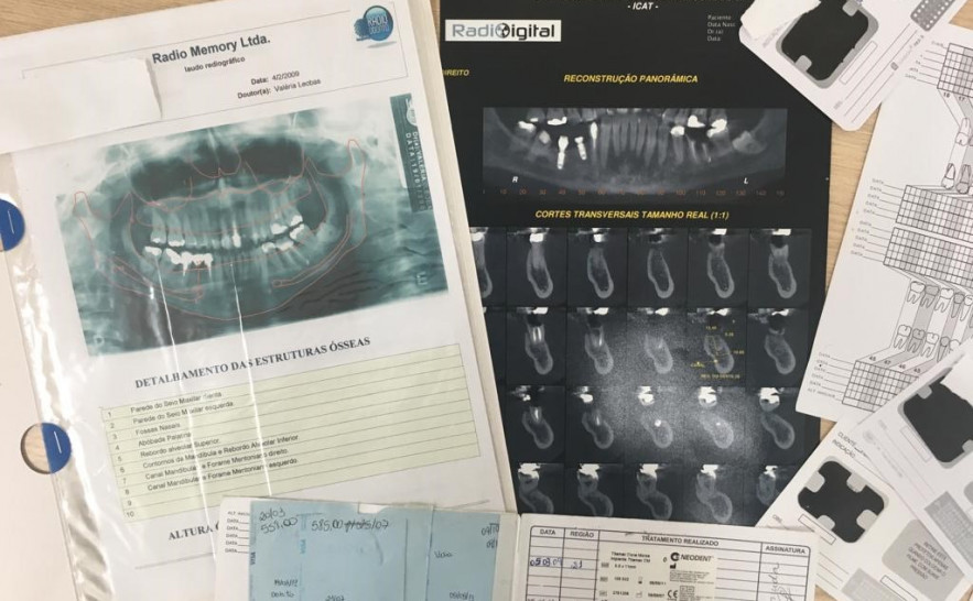 Peritos médicos legais identificam em menos de 5h cadáver por arcada dentária em Dianópolis