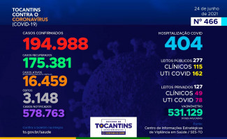 Acompanhe o 466º boletim epidemiológico da Covid-19 no Tocantins 24/06