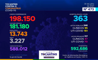 Acompanhe o 473º boletim epidemiológico da Covid-19 no Tocantins 01/07