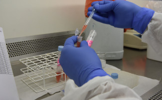LACEN-TO já realizou mais 400 mil testes de RT-qPCR para Covid-19