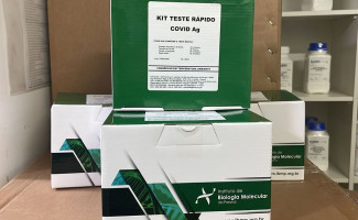 Tocantins recebe mais kits para testes rápidos de detecção da Covid-19 