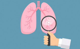 Saúde alerta para prevenção da tuberculose durante o mês de março