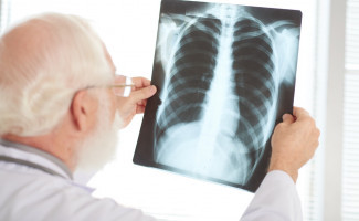 Dia Mundial de Combate à Tuberculose, 24 de março, chama atenção para a prevenção 