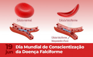 Tocantins oferta atendimento para pacientes com Doença Falciforme pelo SUS