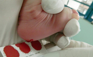 Saúde promove capacitação on-line em triagem neonatal