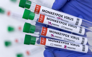 Estado do Tocantins atualiza dados da Monkeypox