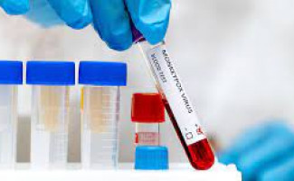 Tocantins conta com 40 casos suspeitos de Monkeypox