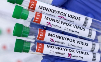 Tocantins tem 45 casos suspeitos de Monkeypox