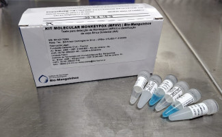 LACEN-TO passa a realizar testes para o diagnóstico laboratorial do vírus Monkeypox