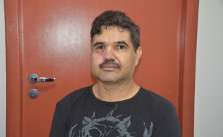 Governo do Tocantins viabiliza cirurgia facial inédita no HGP
