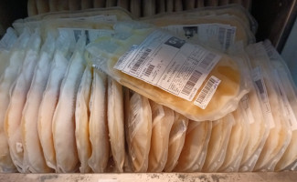 Hemocentro de Palmas vai fornecer plasma excedente para a Hemobrás