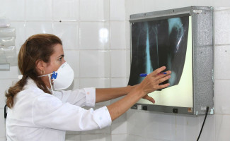Dia Mundial de Combate a Tuberculose alerta para diagnóstico e tratamento da doença