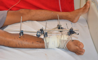 SES-TO destaca o Dia Nacional da Paz no Trânsito