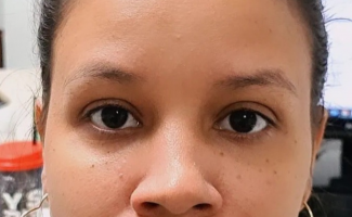 No Dia Nacional de Combate ao Glaucoma, SES-TO alerta para o diagnóstico precoce