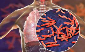 Secretaria de Estado da Saúde alerta a população sobre a tuberculose