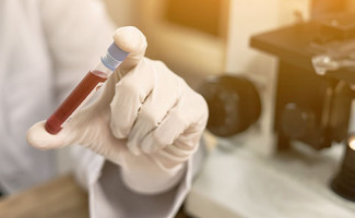 Hemocentro Coordenador de Palmas recebe certificado de excelência 