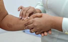 Saúde abre inscrições para o 1° Seminário de Hanseníase do Tocantins