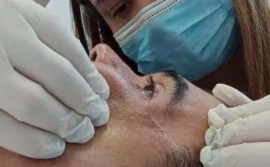 No Julho Verde, SES-TO alerta sobre câncer de cabeça e pescoço