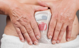 No Dia Nacional dos Ostomizados, SES/TO conscientiza população contra o preconceito