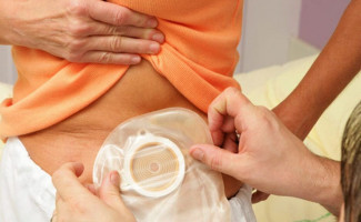 
SES-TO realiza Encontro dos Ostomizados do Tocantins
