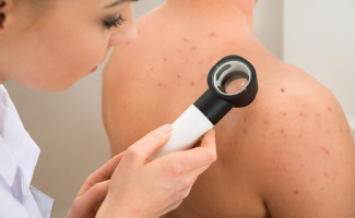 No Dezembro Laranja, SES-TO trabalha a prevenção e detecção precoce do câncer de pele