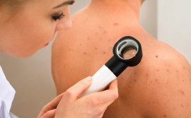 No Dezembro Laranja, SES/TO trabalha a prevenção e a detecção precoce do câncer de pele