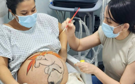 Hospital Regional de Augustinópolis implanta Projeto de Boas Práticas e Humanização no pré-parto 