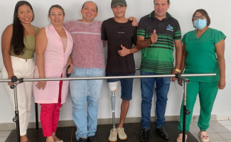 Governo do Tocantins entrega próteses ortopédicas para pacientes no SER em Porto Nacional