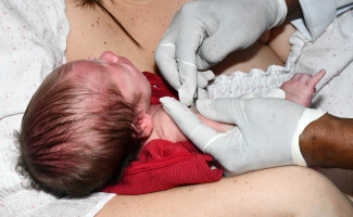 No Dia da Vacina BCG, SES-TO destaca a importância do imunizante contra a tuberculose