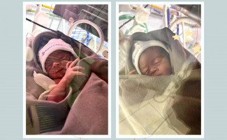 Hospital Regional de Gurupi realiza parto de gêmeos em paciente transeunte