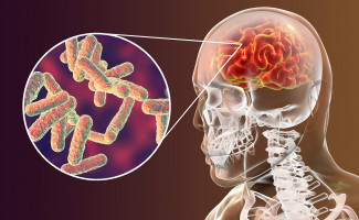 No Dia Mundial da Meningite, SES-TO alerta para prevenção e sintomas 