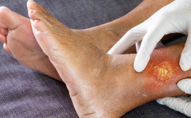 Governo do Tocantins inaugura Ambulatório de Feridas e Reabilitação Tecidual no Hospital Geral de Palmas