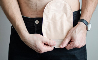 SES-TO realizará o 4º Encontro dos Ostomizados