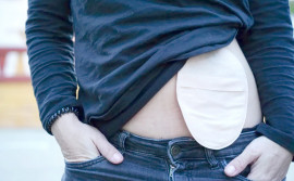 No Dia Nacional dos Ostomizados, SES-TO destaca a importância da informação no combate ao preconceito