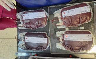 Governo do Tocantins realiza primeira irradiação de hemácias e amplia segurança transfusional para pacientes