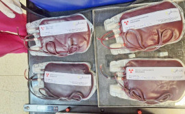 Governo do Tocantins realiza primeira irradiação de hemácias e amplia segurança transfusional para pacientes