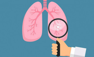 SES-TO reforça prevenção e diagnóstico precoce no Dia Mundial de Combate à Tuberculose