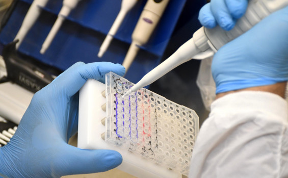 Governo do Tocantins amplia capacidade diagnóstica do Lacen/TO e fortalece vigilância laboratorial no estado 