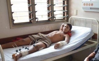 Acidentes de trânsito já encaminharam mais de 1.500 pacientes para o HGP em seis meses