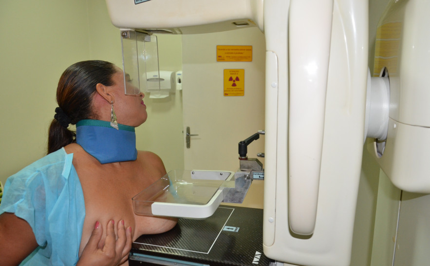 No Tocantins, há mamógrafos que atendem a população, dentro da recomendação do Ministério da Saúde 