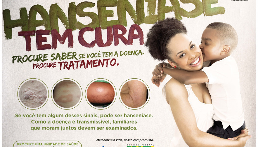 Campanha conscientiza sobre sintomas e tratamento da hanseníase -  Prefeitura de Limeira