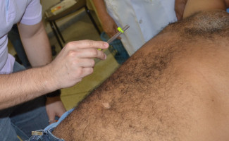 Saúde oferece capacitação sobre hanseníase a 23 municípios 