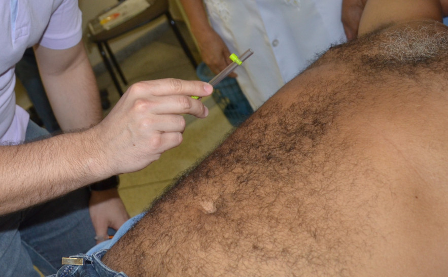 Exame de sensibilidade para diagnóstico da Hanseníase 