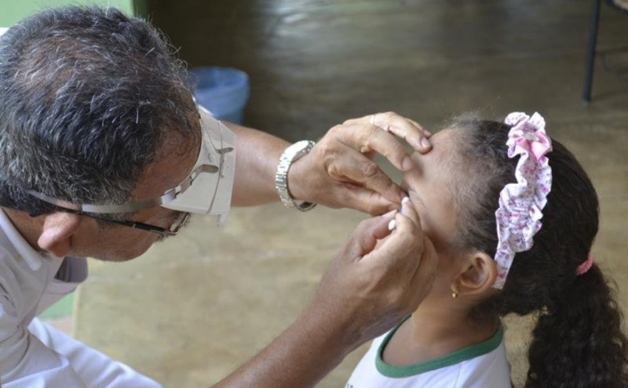 Para facilitar o diagnóstico do tracoma, serão feitos exames oculares externos nos alunos