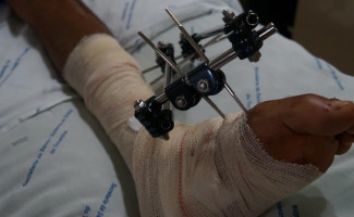 Saúde reforça importância de dados qualificados em ocorrências de acidentes de trânsito