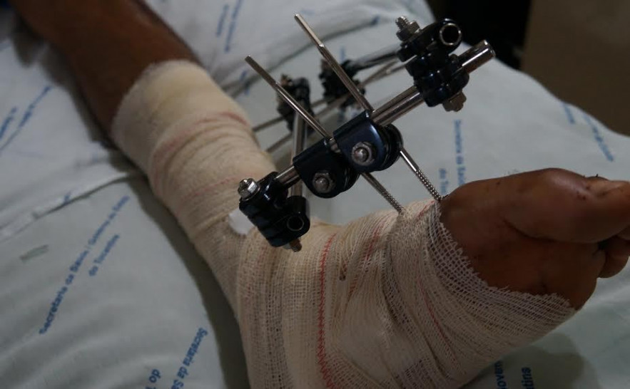 Acidentes de transito deixam sequelas e causam prejuízos a vida dos envolvidos