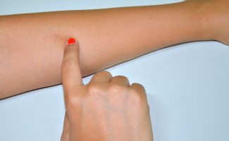 Ação de combate ao câncer de pele acontece no HGP neste sábado